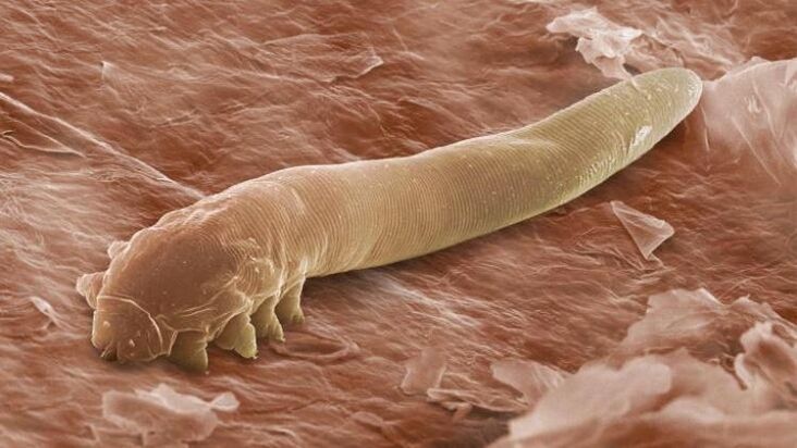 worm die onder de menselijke huid leeft