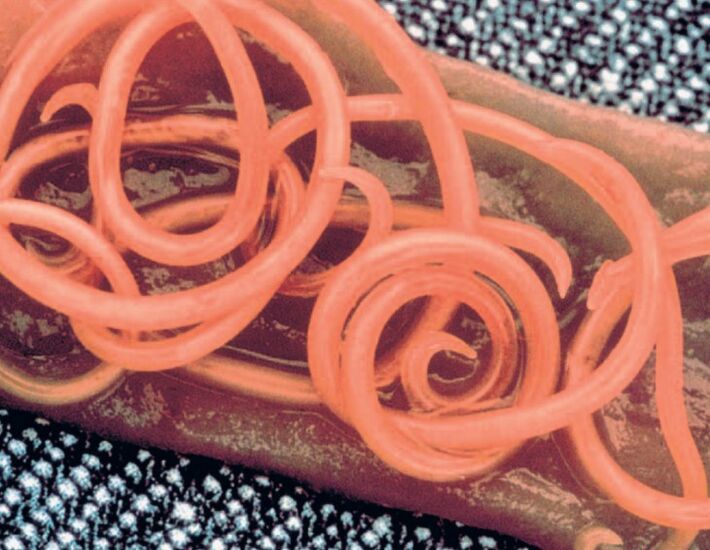 lintwormen uit het menselijk lichaam
