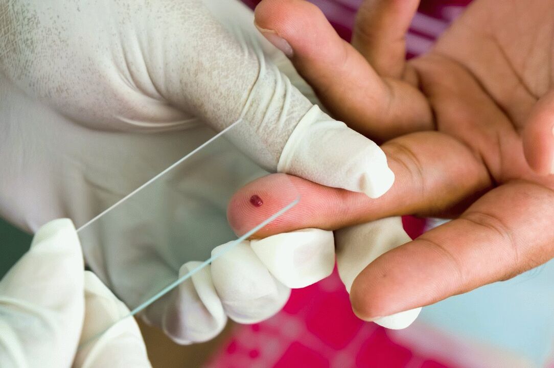 Bloedtest van de vinger