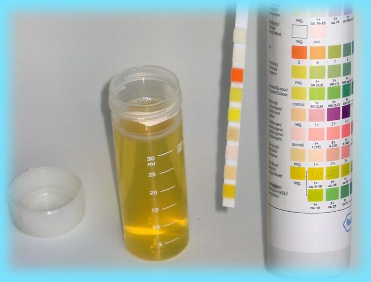 Urine -analyse