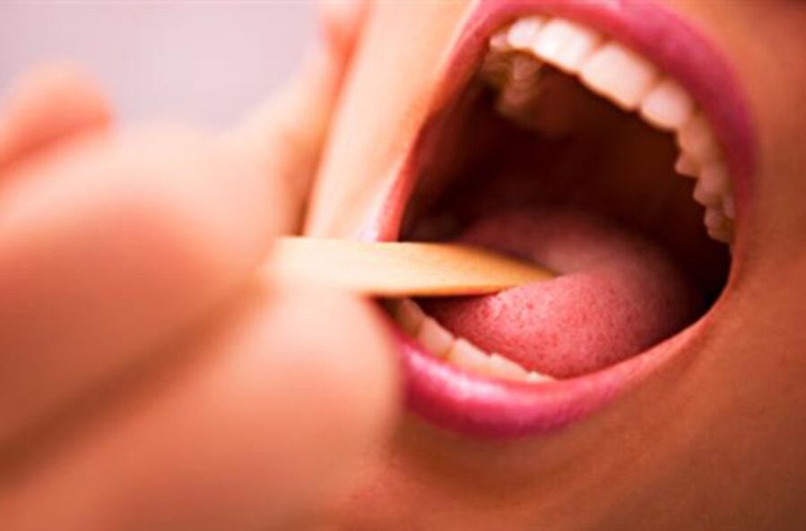 soorten parasieten in de menselijke mond